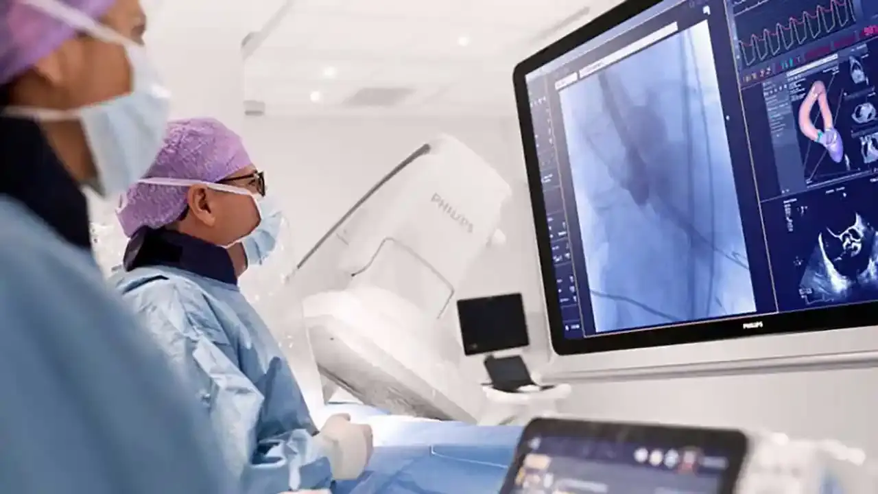 مراحل انجام آنژیوگرافی - نبض هوشمند سلامت